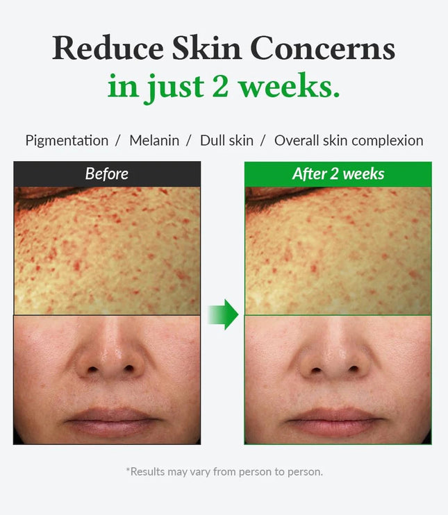 Dr. Althea Gentle Vitamin C 20% 30ml